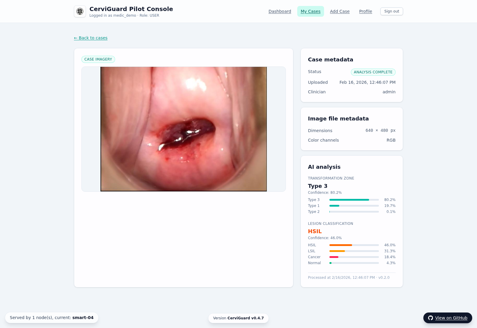 CerviGuard case detail page with AI analysis metadata
