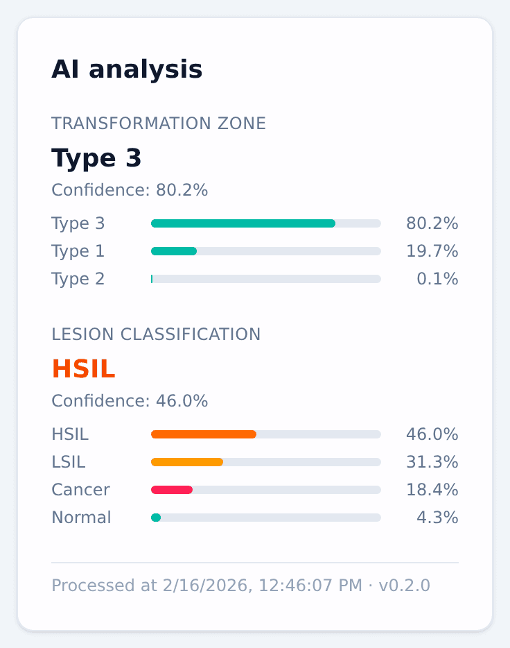 CerviGuard AI analysis output: transformation-zone type and lesion classification with per-class confidence bars.